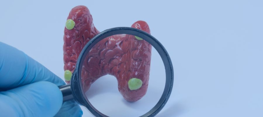 Hiperparatireoidismo Dra Luciana Menta Endocrinologista
